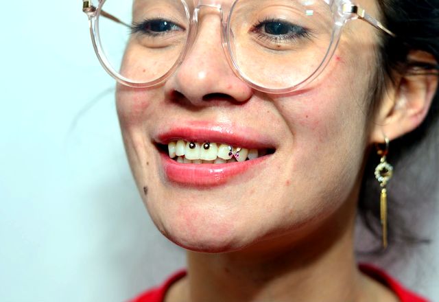 Gemas dentales